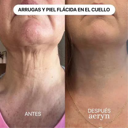 🌸 Escultor facial LED 7 en 1 Lumine + SÉRUM EXTRA DE REGALO 💧💆‍♀️