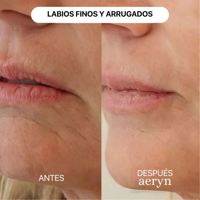 🌸 Escultor facial LED 7 en 1 Lumine + SÉRUM EXTRA DE REGALO 💧💆‍♀️