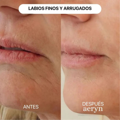 🌸 Escultor facial LED 7 en 1 Lumine + SÉRUM EXTRA DE REGALO 💧💆‍♀️