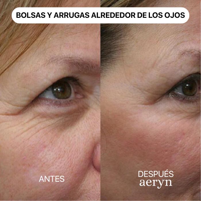 🌸 Escultor facial LED 7 en 1 Lumine + SÉRUM EXTRA DE REGALO 💧💆‍♀️