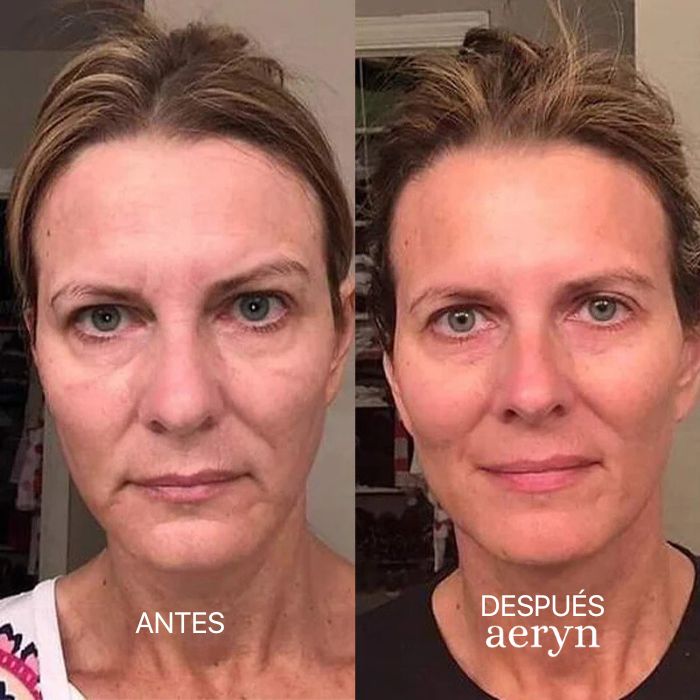 🌸 Escultor facial LED 7 en 1 Lumine + SÉRUM EXTRA DE REGALO 💧💆‍♀️