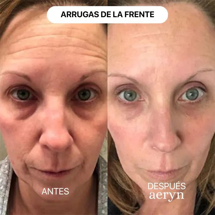 🌸 Escultor facial LED 7 en 1 Lumine + SÉRUM EXTRA DE REGALO 💧💆‍♀️