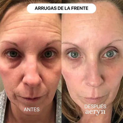 🌸 Escultor facial LED 7 en 1 Lumine + SÉRUM EXTRA DE REGALO 💧💆‍♀️