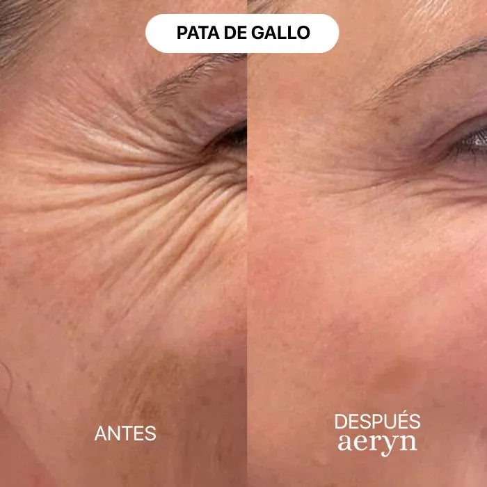 🌸 Escultor facial LED 7 en 1 Lumine + SÉRUM EXTRA DE REGALO 💧💆‍♀️