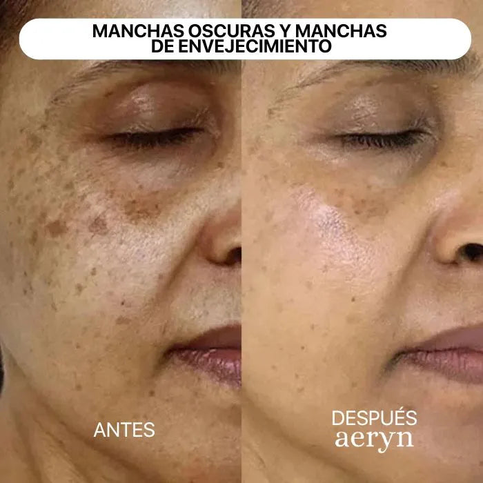 🌸 Escultor facial LED 7 en 1 Lumine + SÉRUM EXTRA DE REGALO 💧💆‍♀️