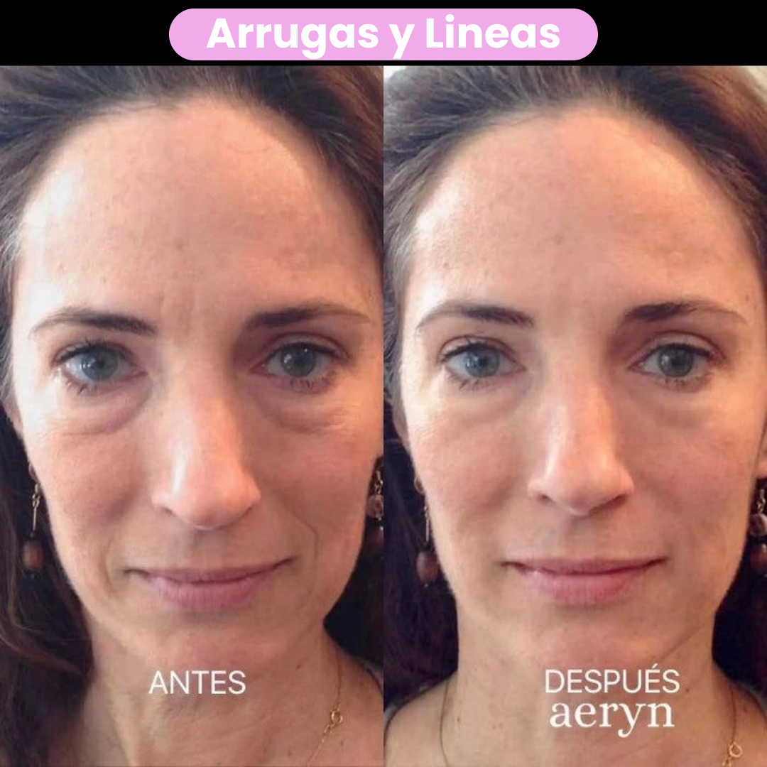 🌸 Escultor facial LED 7 en 1 Lumine + SÉRUM EXTRA DE REGALO 💧💆‍♀️